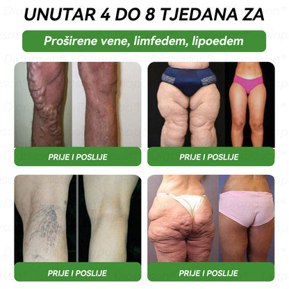 𝑆𝑙𝑢ž𝑏𝑒𝑛𝑎 𝑇𝑟𝑔𝑜𝑣𝑖𝑛𝑎 | 👩🏻‍⚕️🎁 Osam u jednom – oralna tekućina za zdravlje — podrška u kontroli tjelesne težine, razini energije, ravnoteži organizma, zdravlju zglobova i općem blagostanju.