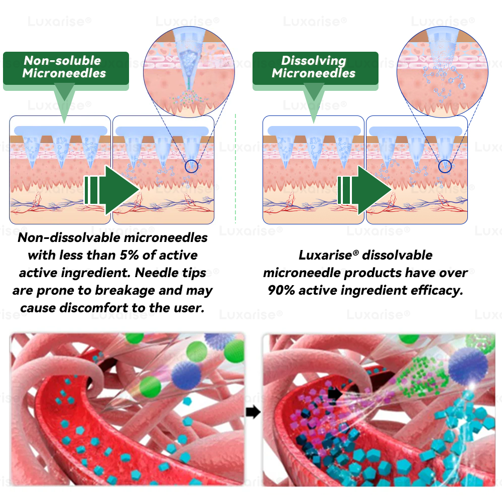 Službena trgovina | 👩‍⚕️Luxarise® Moringa i Berberin 10-u-1 napredni nano flaster s mikroiglama (jednom dnevno, vidljive promjene za 7 dana) ✅Pretilost, dijabetes, apneja u snu i problemi sa zglobovima🥦