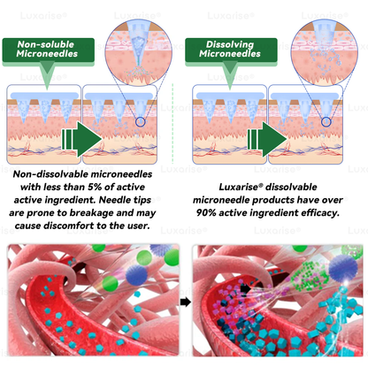 Službena trgovina | 👩‍⚕️Luxarise® Moringa i Berberin 10-u-1 napredni nano flaster s mikroiglama (jednom dnevno, vidljive promjene za 7 dana) ✅Pretilost, dijabetes, apneja u snu i problemi sa zglobovima🥦